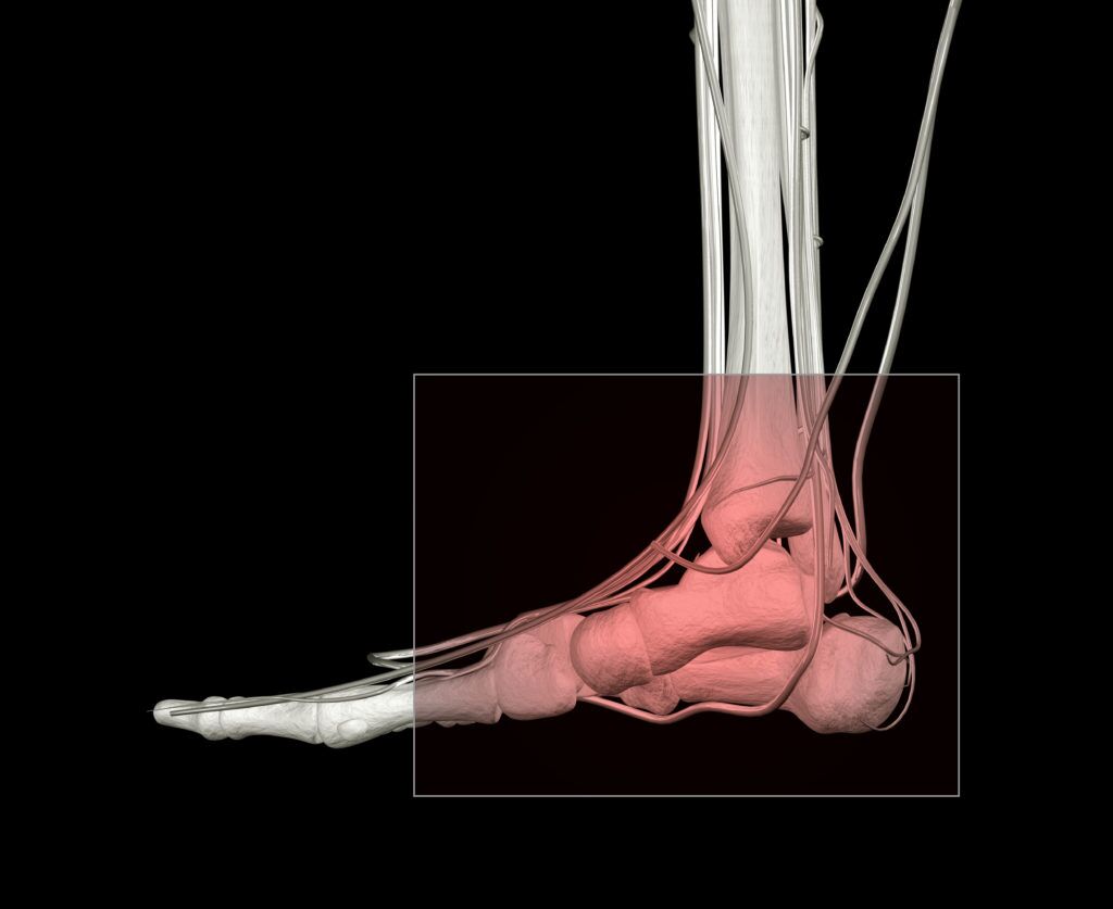 All About Stress Fractures: Causes, Symptoms, Treatment, and Prevention:  Neuhaus Foot & Ankle: Podiatry