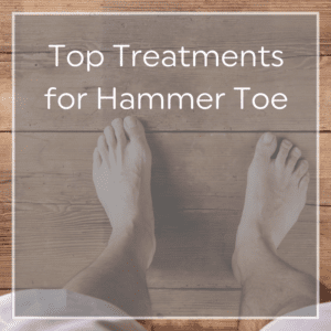 Hammer Toes Diagnosis prevention treatment - Yashoda Hospitals